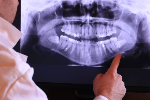 Best Teeth Whitening  in Burt, MI
