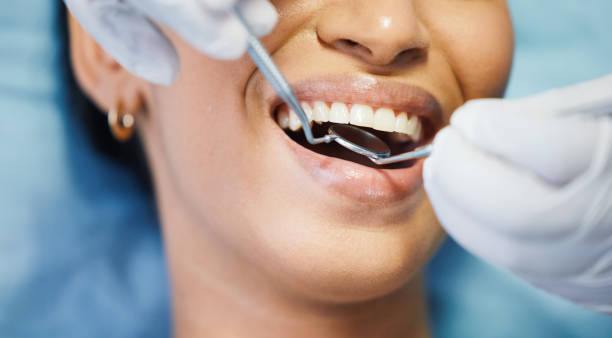 Best Cracked Tooth Emergency Dentist  in Burt, MI